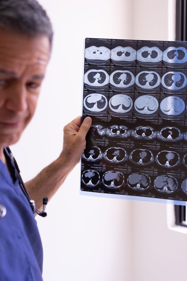 A doctor examining a chest X-ray film against a viewing light